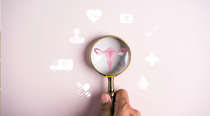 Regl (Menstrüasyon – Adet) Nedir? Ağrısı Nasıl Geçer?